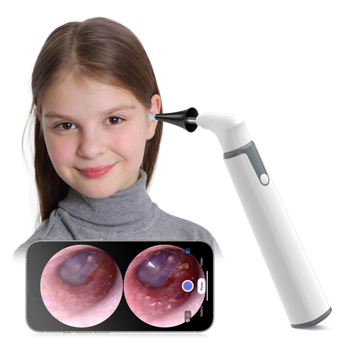 Anykit Wireless Otoscope Ear Camera with Dual View, 3.9mm 720PHD WiFi Ear Scope with Ear Wax Removal Tool for Kids and Adults & Pets, Compatible with Android and iPhone