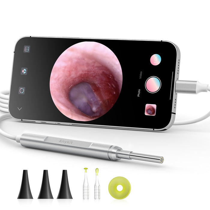 Anykit Digital Otoscope for iPhone, iPad & Android Device, Ultra Clear View Ear Camera with Ear Wax Removal Tools, Video Ear Scope Otoscope with Light, Support Capture Photo & Record Videos