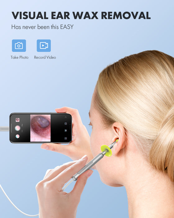 Anykit Digital Otoscope for iPhone, iPad & Android Device, Ultra Clear View Ear Camera with Ear Wax Removal Tools, Video Ear Scope Otoscope with Light, Support Capture Photo & Record Videos