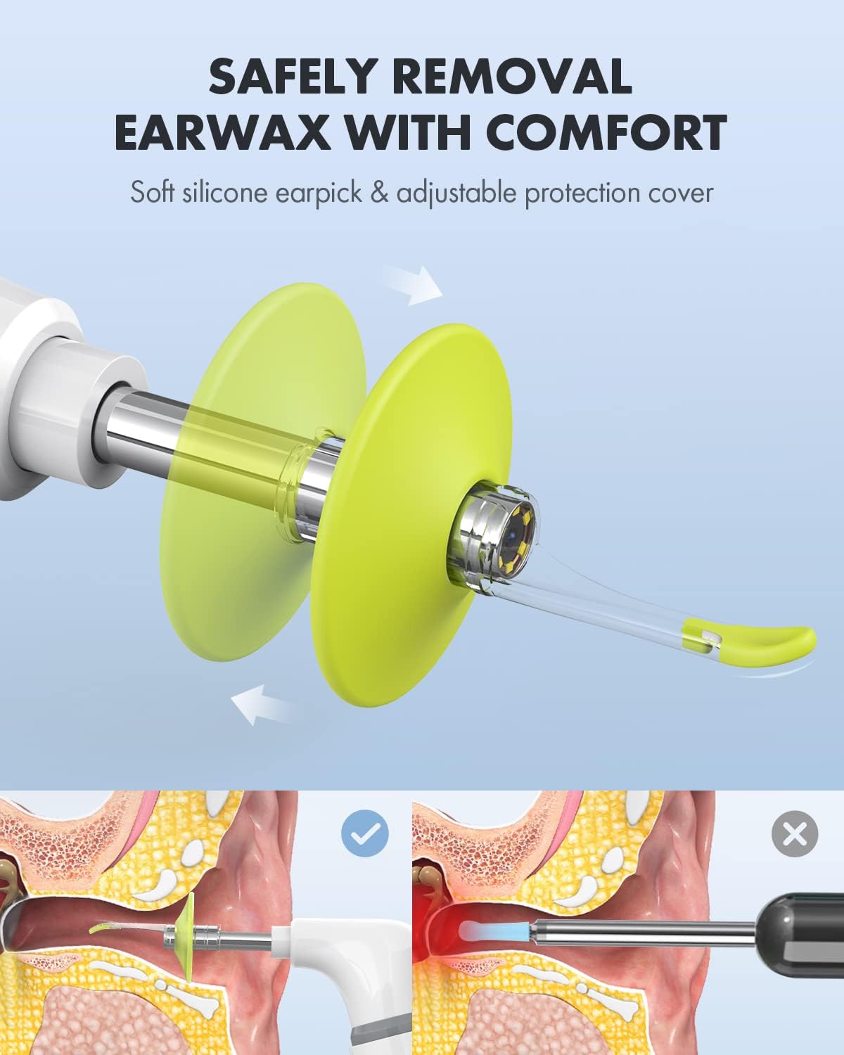 Ear Wax Removal Tool, Ear Spoon, Ear Pick for Anykit/ScopeAround Otoscope (3.9mm w/Protection Shield)