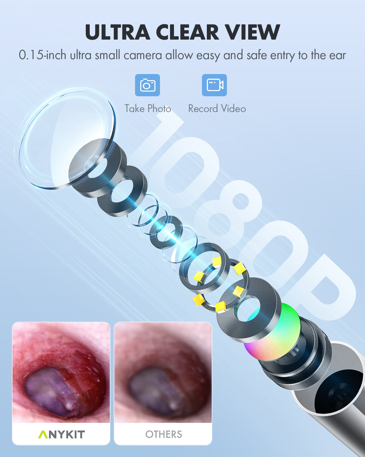 Anykit Digital Otoscope with Gyroscope, 4-inch IPS Screen, HD Ear Came
