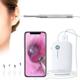 Anykit Ear Wax Removal Tool, HD Otoscope Ear Cleaner for iPhone & Android, Ultra Clear View Ear Camera with Ear Wax Remover, Ear Endoscope with LED Lights, Ear Cleaning Camera with Ear Spoon
