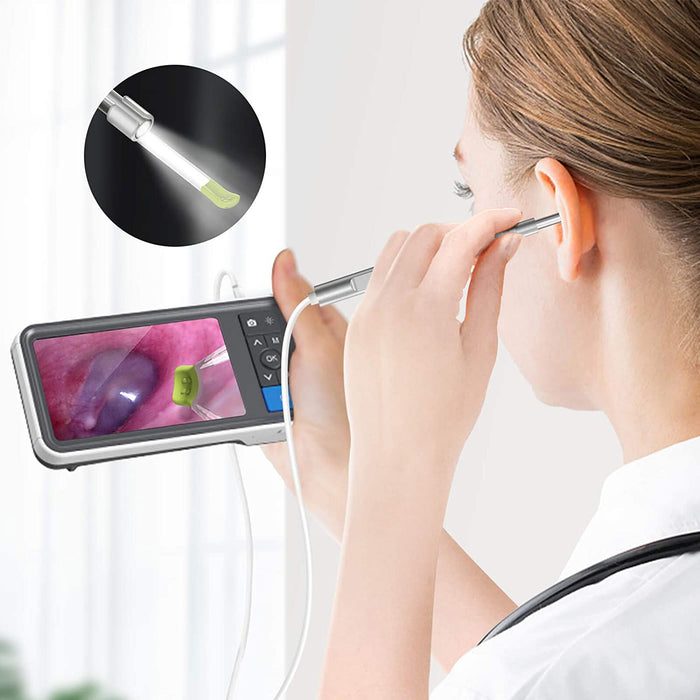 Digital Otoscope with 4.5 Inches Screen, Anykit 3.9mm Ear Camera with 6 LED Lights, 32GB Card, Ear Wax Removal Tool, Specula and 2500 mAh Rechargeable Battery, Supports Photo Snap and Video Recording