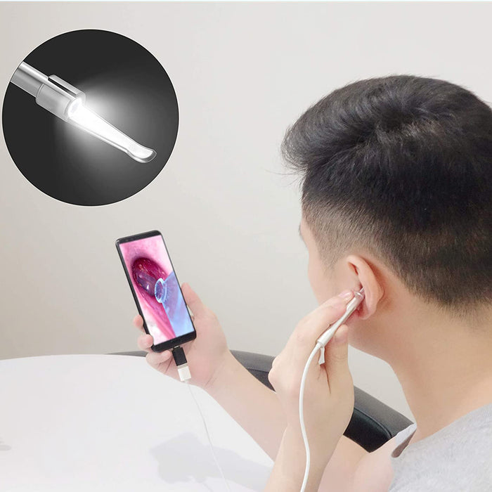 Digital Otoscope with Light, Ear Camera with Ear Wax Removal Tool,  ScopeAround Ear Cleaning Camera with 5 Screen for Kids, Adults & Pets, Ear  Scope